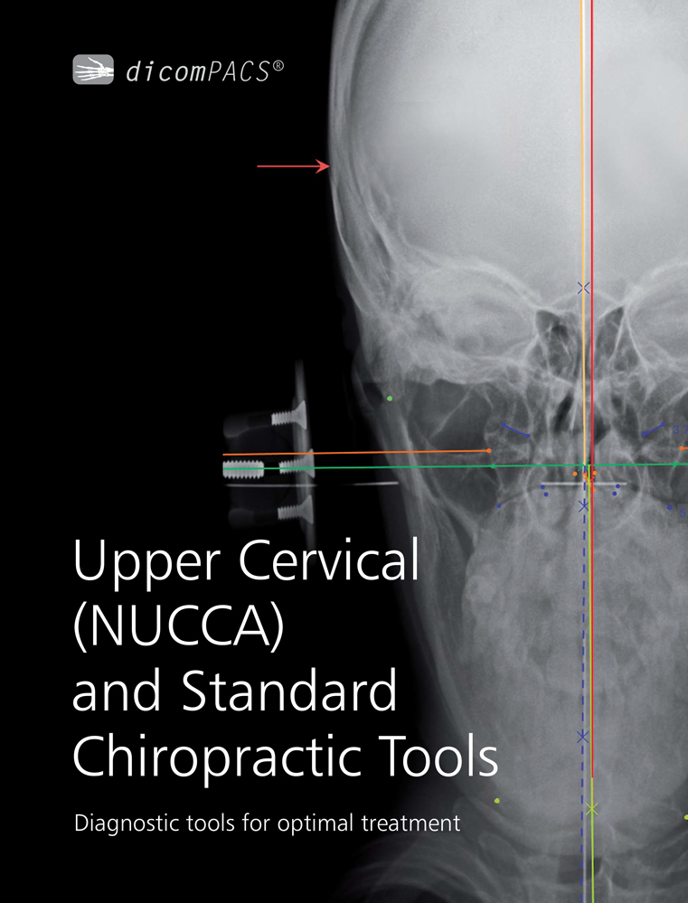 OR dicomPACS X-Ray Software